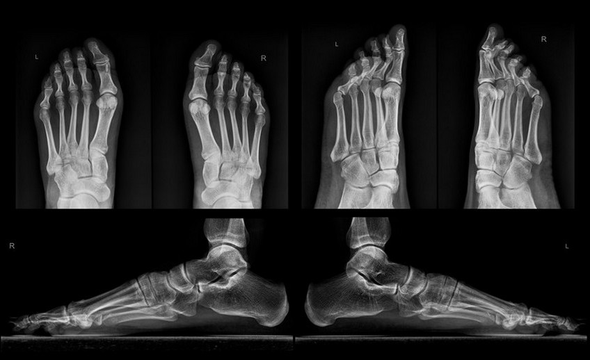 Digital X-Ray Sujata Birla Hospital