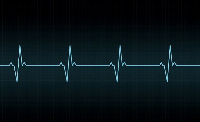 ECG Sujata Birla Hospital