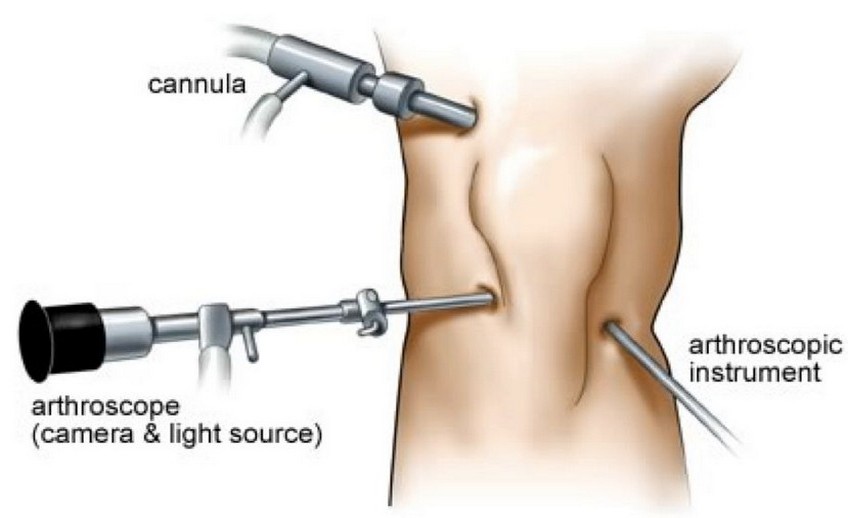 Orthoscopy Sujata Birla Hospital