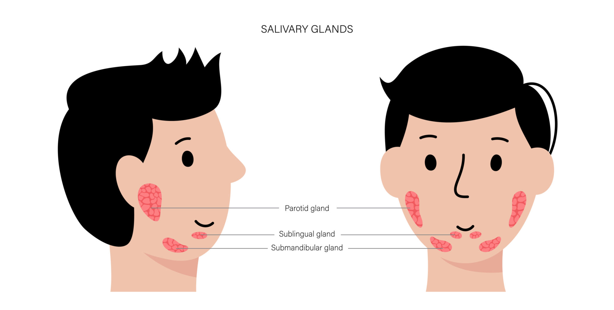 Parotid Gland Swelling Causes