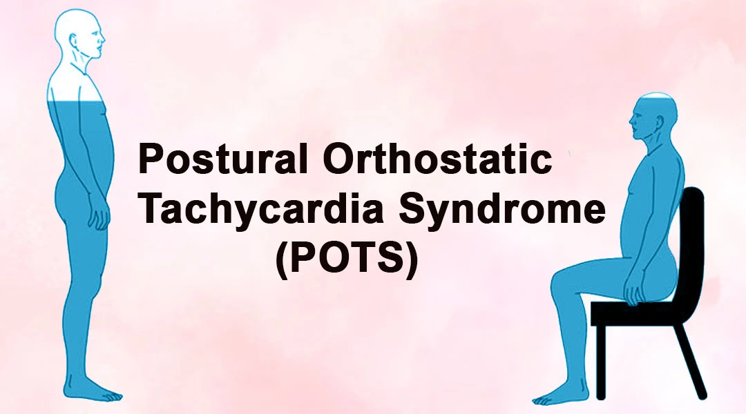 Postural Orthostatic Tachycardia Syndrome (POTS)